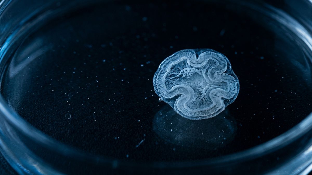 A cerebral organoid showing self-organized layering, suspended in clear medium under cool blue clinical light.